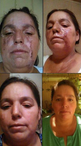 Rapid Rapair Night Cream Results